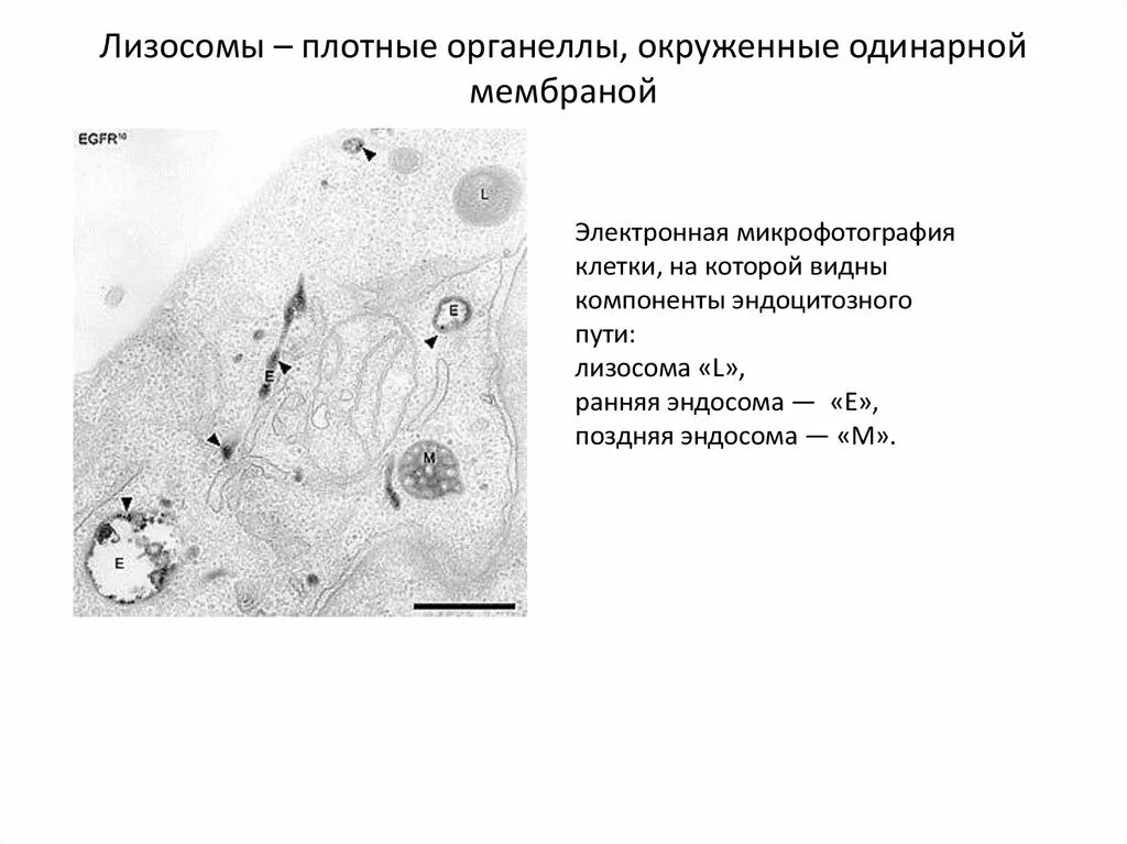 Объект лизосома центриоль процесс внутриклеточное пищеварение. Лизосома электронная микрофотография. Эндосома микрофотография. Электронные микрофотографии органелл клетки. Лизосомы строение.