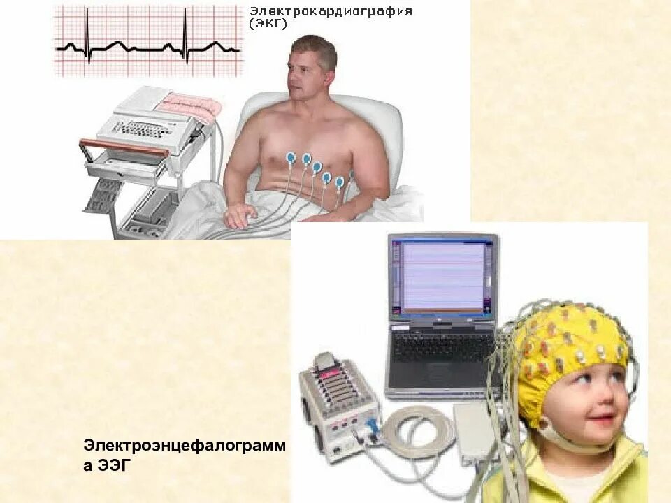 Регистрация ээг. ЭКГ И ЭЭГ. Электроэнцефалограмма. ЭЭГ аппарат. Аппаратура для проведения ЭЭГ.