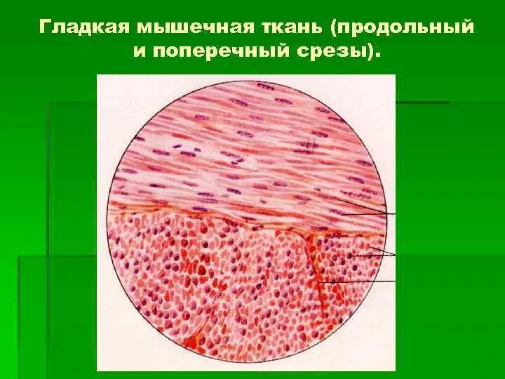 Поперечный и продольный срез. Гладкая и поперечная мышечная ткань. Срез гладкой мышечной ткани. Поперечный разрез гладкой мышечной ткани. Гладкая мышечная ткань поперечный срез.