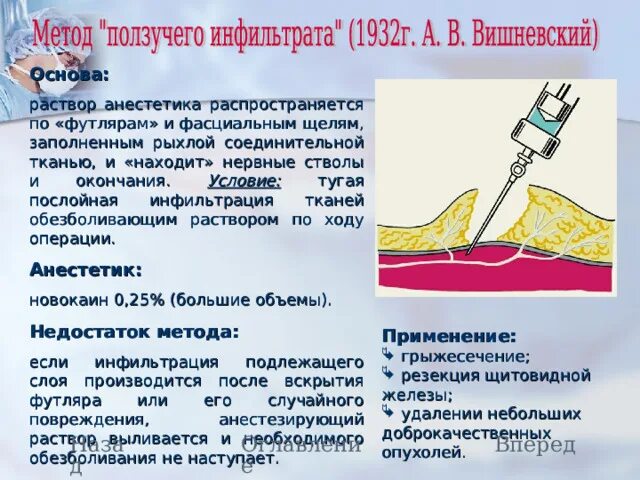 Малрой местная анестезия. Раствор анестетика. Раствор обезболивающий местного. Тумесцентная анестезия. Поверхностная местная анестезия