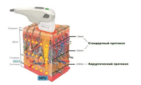 Смас слой