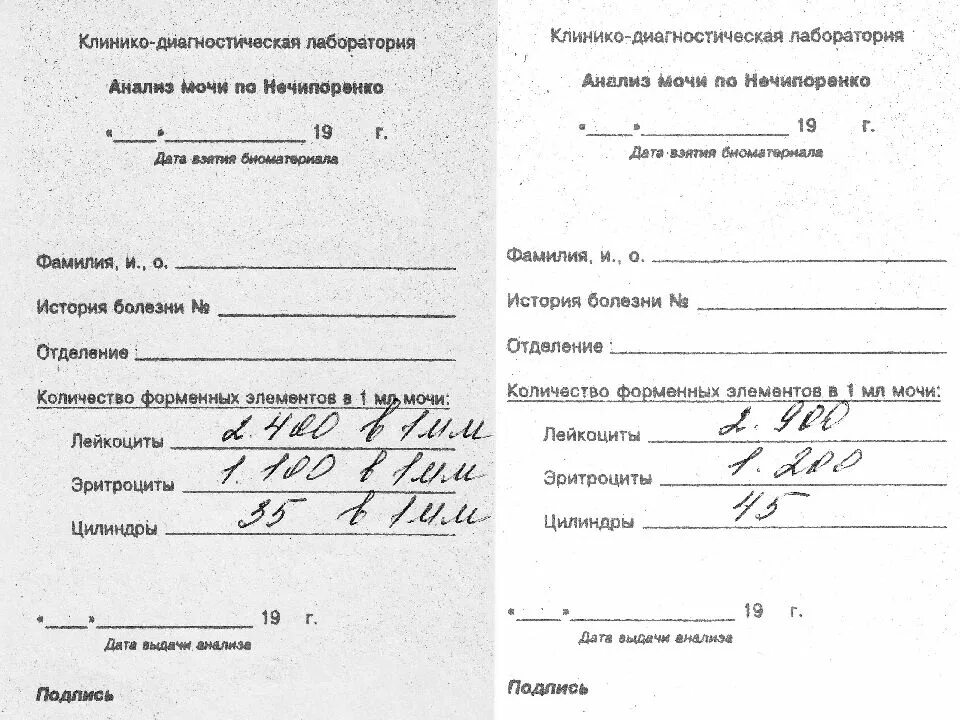 Цель мочи по нечипоренко определение. Направление на анализ по нечипоренко. направление на анализ мочи по нечипоренко бланк. направление на лабораторное исследование мочи по нечипоренко. направление на нечипоренко образец анализ мочи.