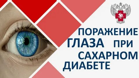 Зрение при сахарном диабете
