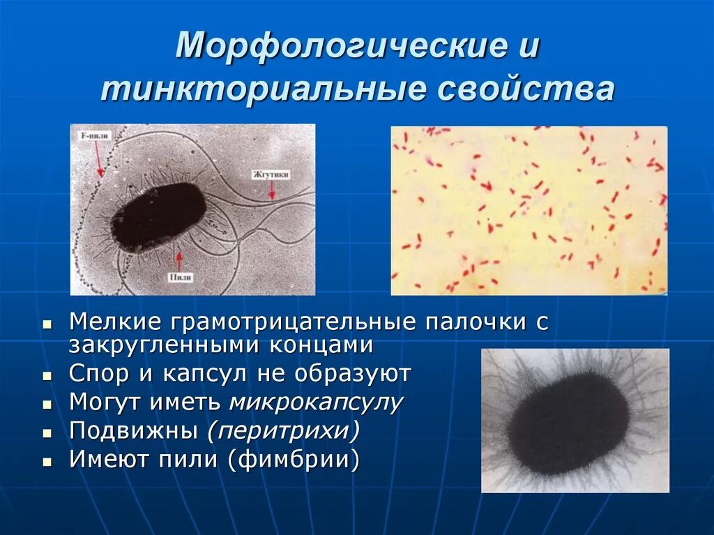 Свойства кишечной палочки. Дизентерия морфологические и тинкториальные свойства. Возбудители инфекций. Возбудители кишечных инфекций. Морфологические и тинкториальные свойства гонококка.