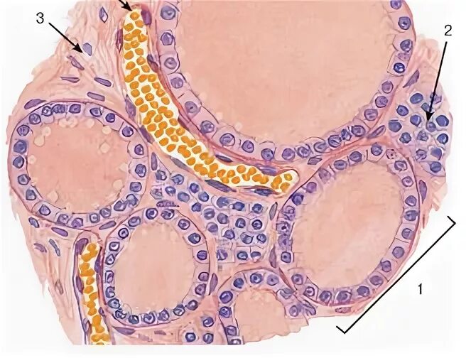 Интерфолликулярные островки щитовидная железа. Интерфолликулярные клетки щитовидной железы. Щитовидная железа гистология интерфолликулярный островок. Парафолликулярных клетках щитовидной железы. Фолликул тироцита