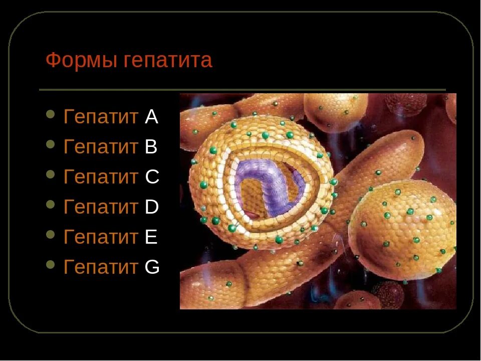 Какая форма гепатита. Формы гепатита. Типы гепатита. Гепатит g презентация.