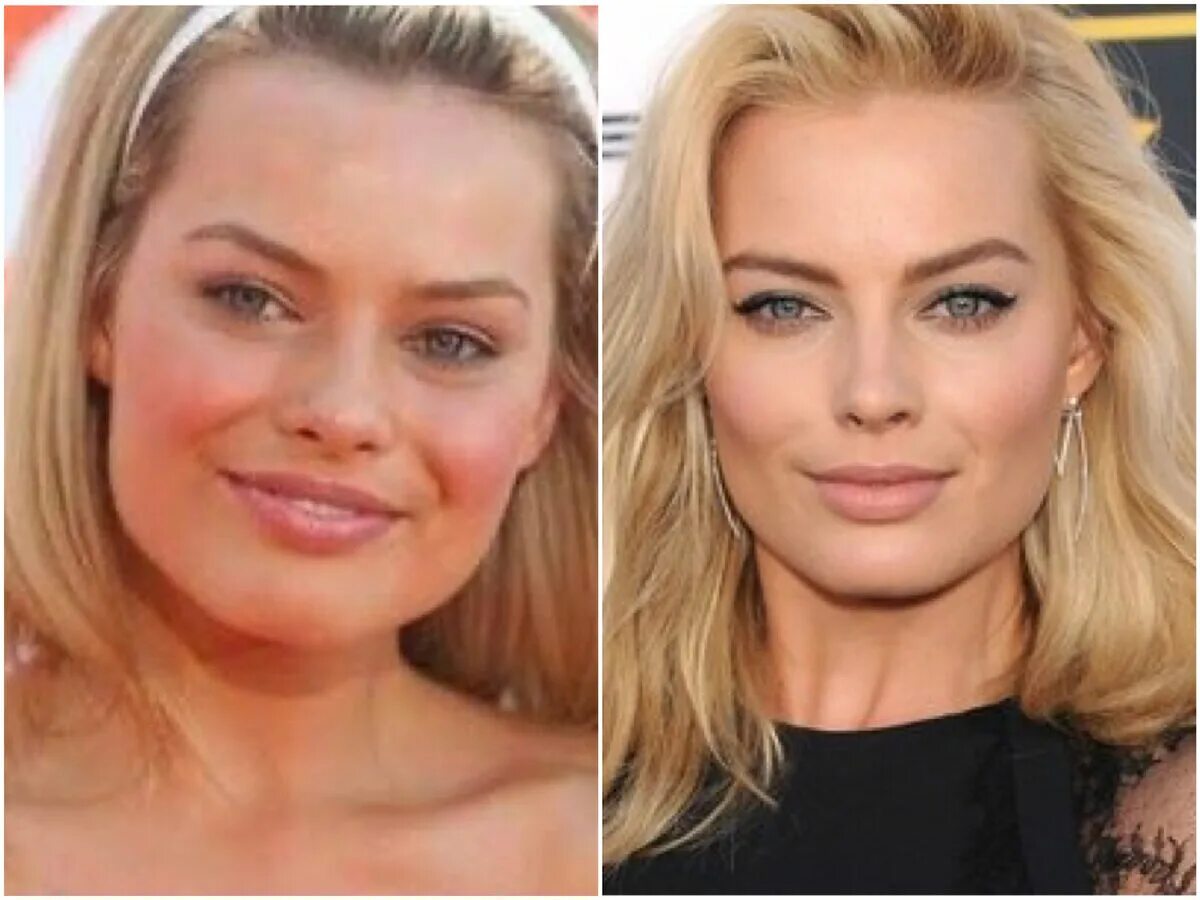 Марго робби комки биша. Марго робби в молодости. Марго после пластики фото. Марго робби пластические операции. Марго после пластики фото.