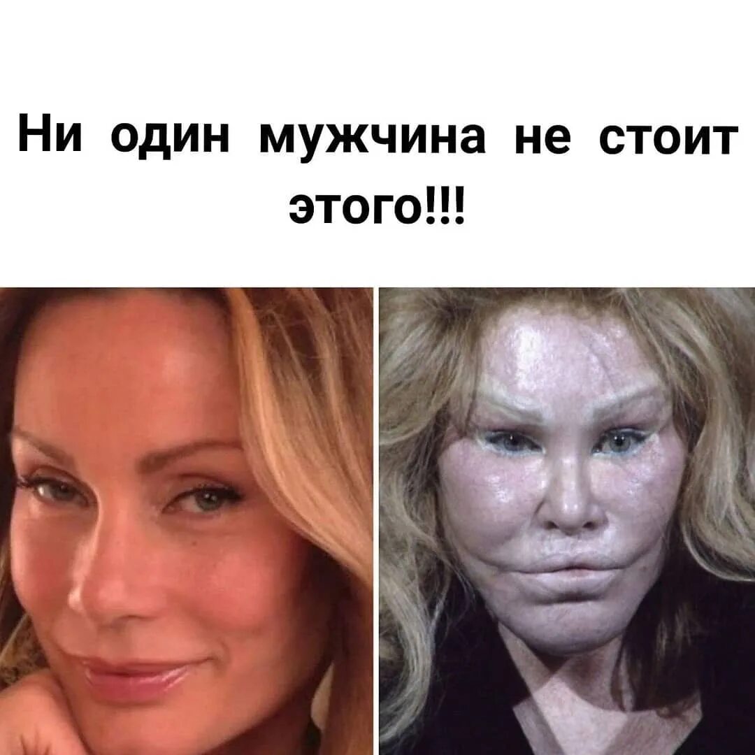 Операция ботокс
