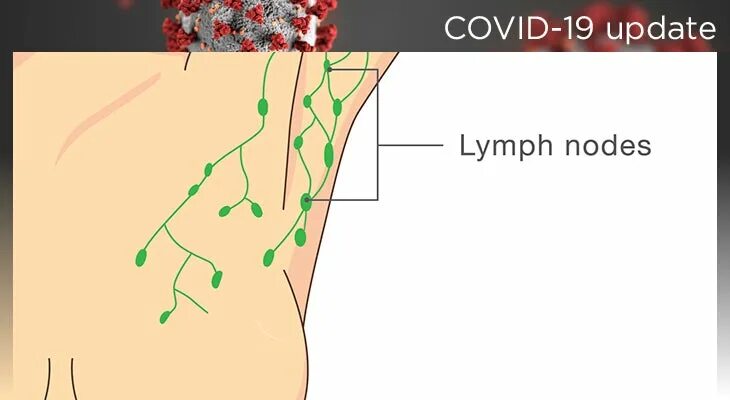 Лимфоузлы под мышками расположение у женщин. Воспалились лимфоузлы под мышкой. Воспалённые лимфатические узлы. Воспаление лимфоузлов в паху.