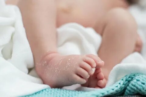 Сухая кожа 5 месяцев