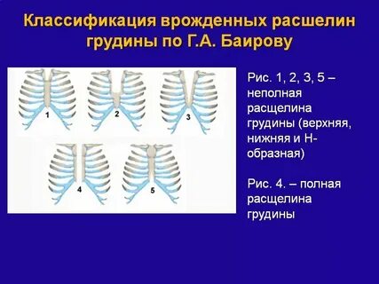 Грудная клетка у детей 3 лет