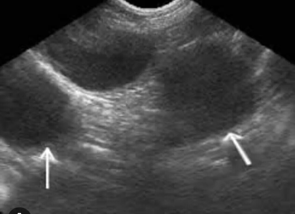 Матка и яичники кошки. УЗИ матки собаки при пиометре.