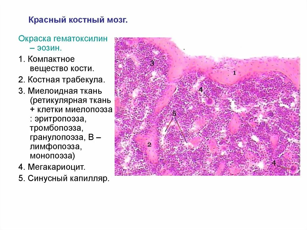 Красный костный мозг гистологический препарат. Красный костный мозг препарат строение. Срез костного мозга гистология препарат. Срез красного костного мозга гистология.