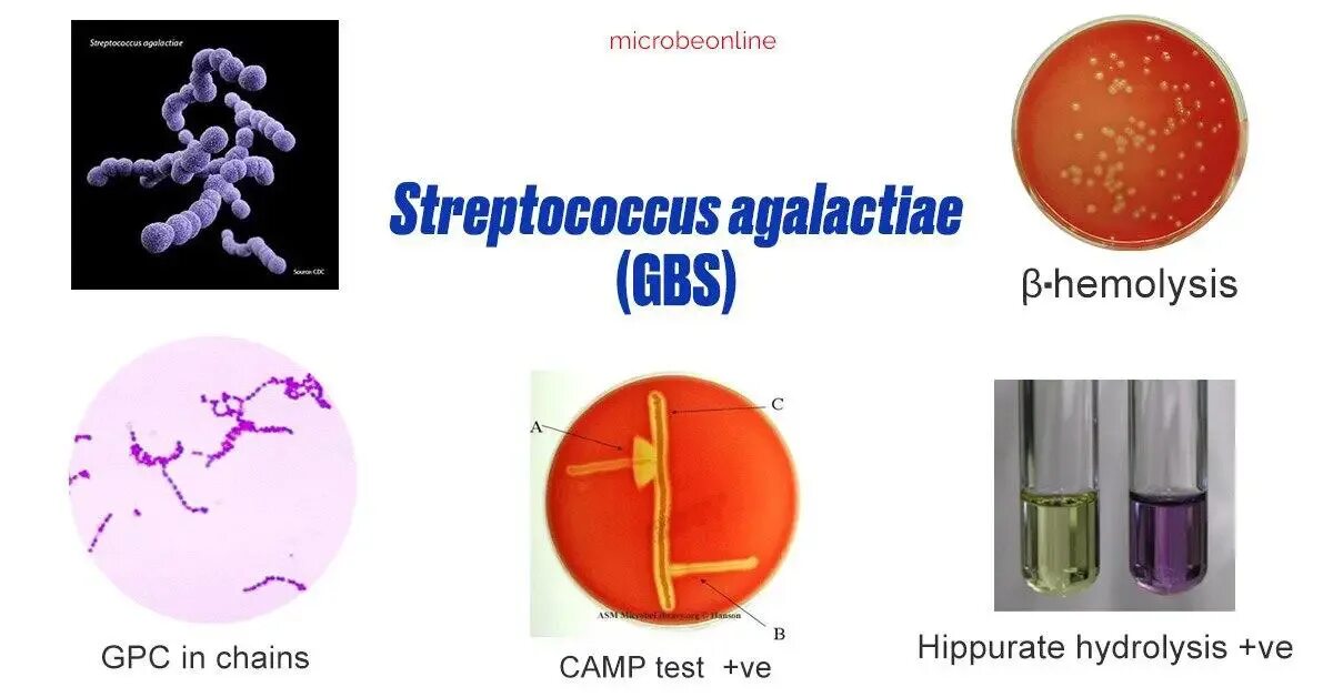 Streptococcus agalactiae (s.pyogenes, s.Viridans, s.pneumoniae). Β-гемолитический стрептококк. Streptococcus agalactiae токсины.