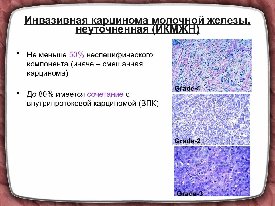 Инвазивная карцинома молочной железы неспецифического типа