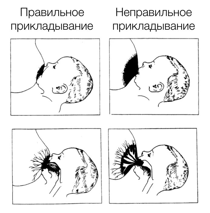 Как правильно прикладывать руку. Техника прикладывания при грудном вскармливании. схема грудного вскармливания новорожденного. грудное вскармливание правильное прикладывание. прикладывание ребенка при кормлении техника.