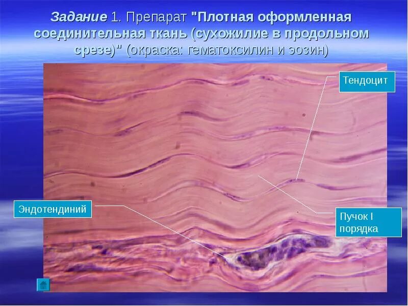 Плотная оформленная ткань сухожилия