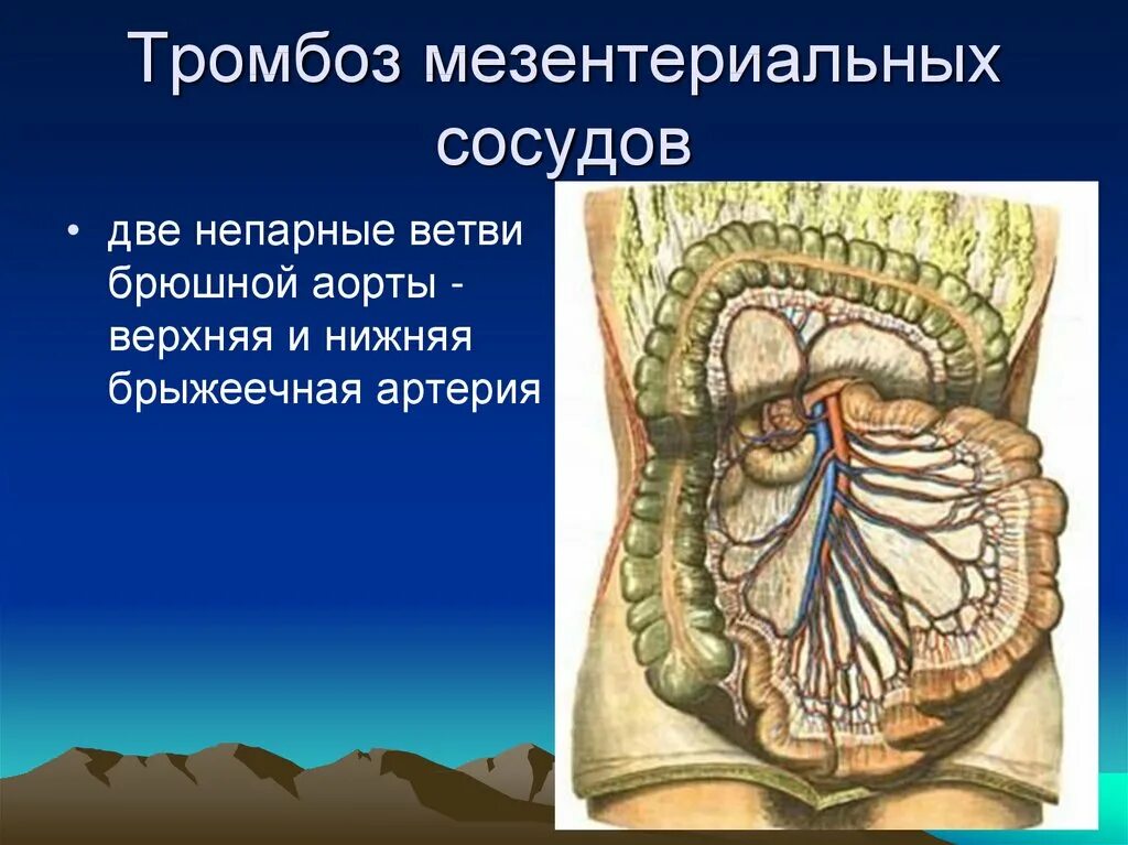 Мезентериальные сосуды кишечника. Тромбоз сосудов брыжейки. Тромбоз мезентериальные сосуды. Мезентериальный тромбоз симптомы. Мезентериальный тромбоз код