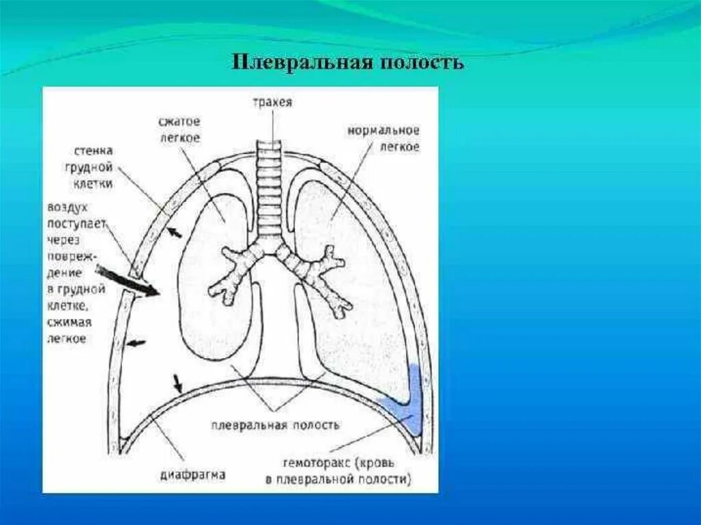 Органы плевральной полости. Плевральные полости, синусы плевры. Плевральная полость 6)  плевра. Легкие и плевральная полость. Плевральная полость легких.