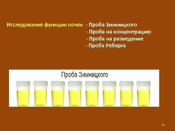 Как сдавать мочу по зимницкому. Исследование мочи по зимницкому цель исследования. проба нечипоренко зимницкого реберга. алгоритм сбора мочи на анализ по методу зимницкого. исследование функции почек проба зимницкого.