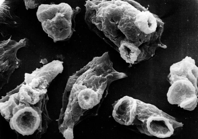 Амеба поедает мозги. Амеба поедает мозги. Амеба поедает мозги. Неглерия фоулера – амеба, пожирающая мозг. Амеба неглерия фоулера.