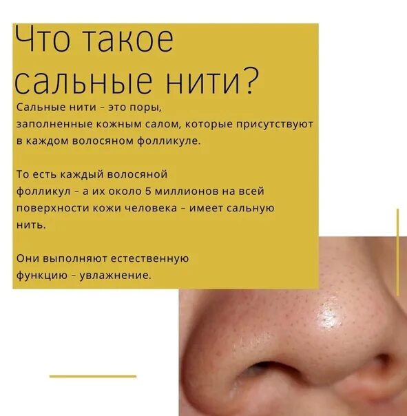 Сальные нити на лице как выглядят Сальные нити на лице как выглядят