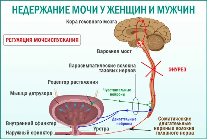 Жжение в простате. Схема процесса мочеиспускания. Причины недержания мочи. Недержание мочи у мужчин. Тотальное недержание мочи.