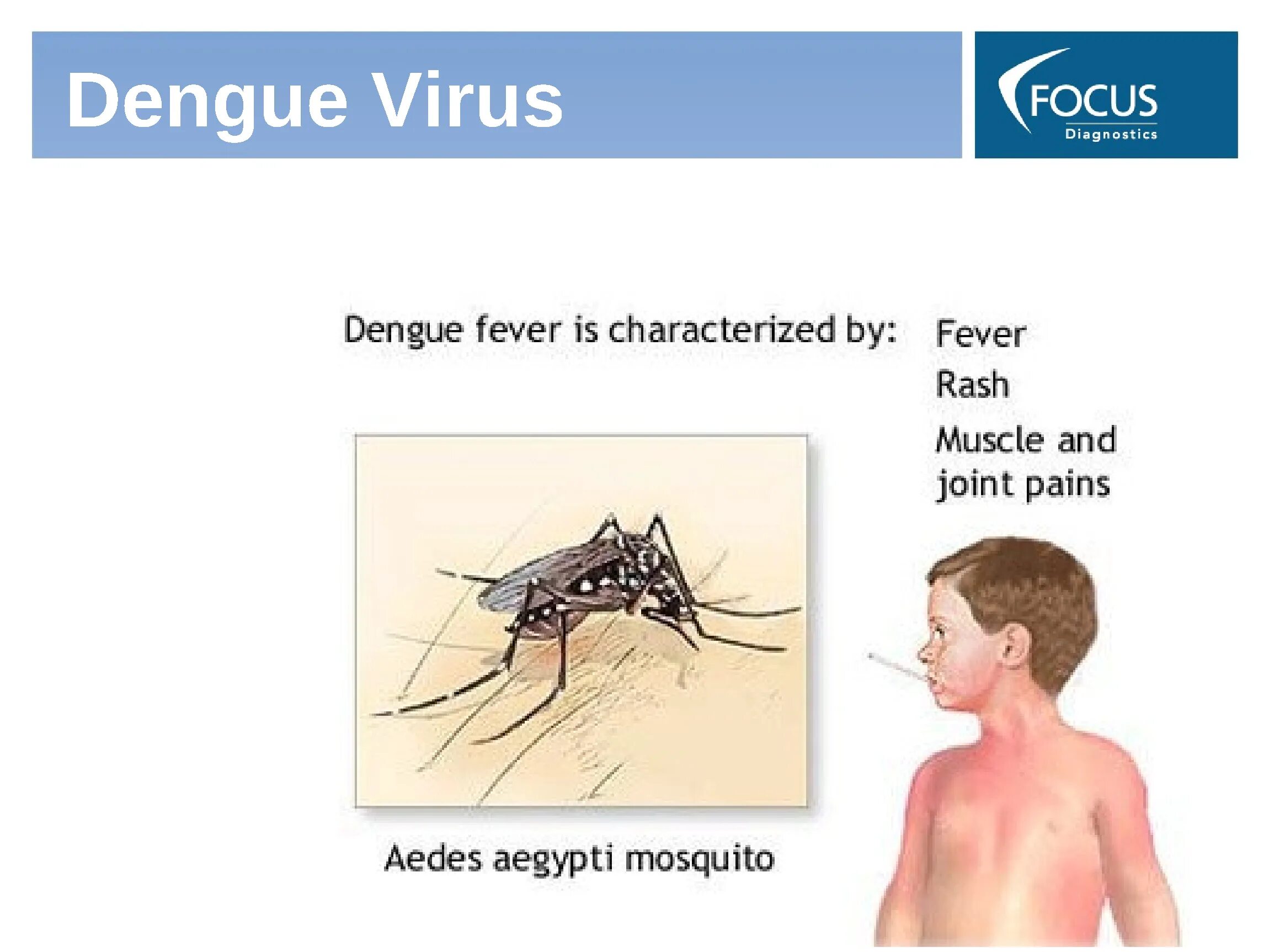 Симптомы денге у детей. Вирус эпштейна-барр мононуклеоз. Симптомы денге у детей. Геморрагическая лихорадка денге. Симптомы денге у детей.