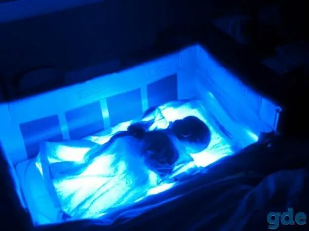 Лампа от желтушки для новорожденного. Сколько держат под лампой при желтушке. Фототерапия для новорожденных. Ультрафиолет для новорожденного. Лампа для новорожденных от желтушки в роддоме.