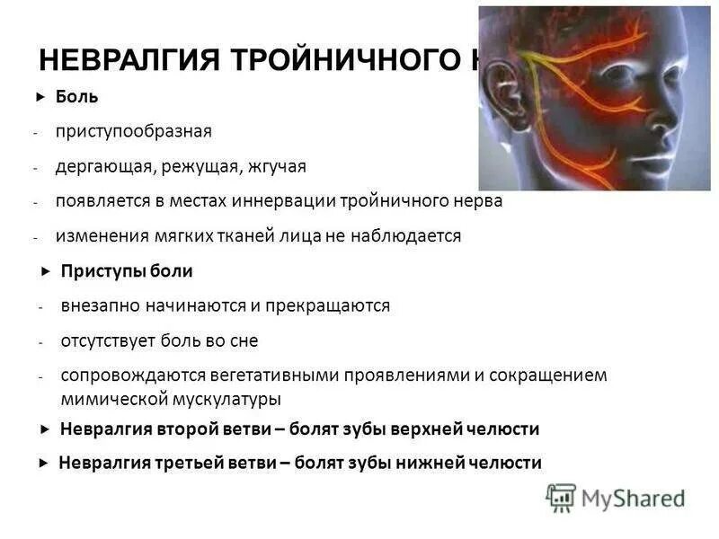Как отличить зубную боль от воспаления. Невралгия тройничного нерва боль. боль при воспалении тройничного нерва. острая невралгия тройничного нерва. боль при тройничном нерве.