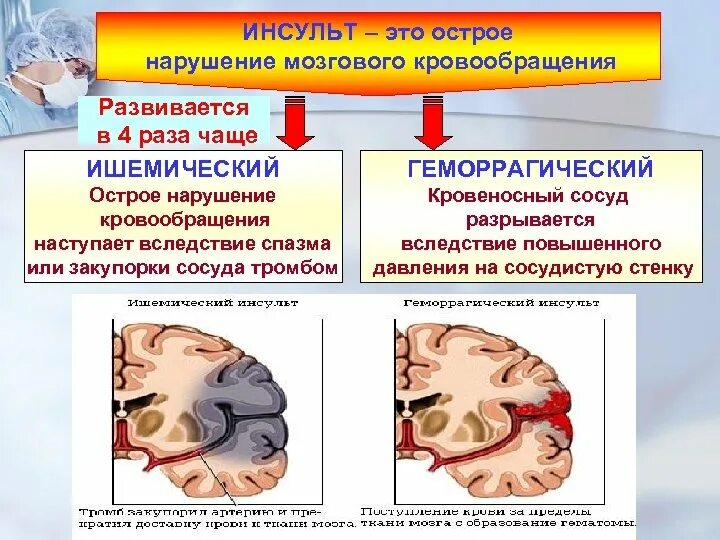 Мозговой инсульт (этиология, патогенез, клиника).. 1. Острые нарушения мозгового кровообращения. Классификация. Механизм геморрагического инсульта. Острый ишемический инсульт. Острые нарушения головного кровообращения