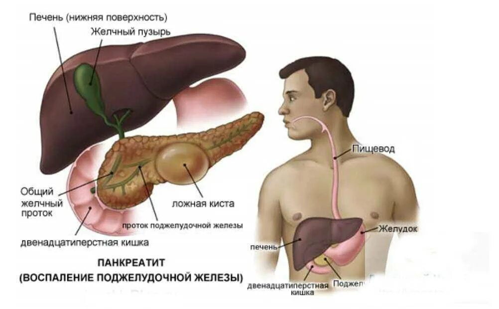 От чего появляется панкреатит. Поджелудочная железа фото. Фото поджелудочной железы у человека. Печень и поджелудочная железа.