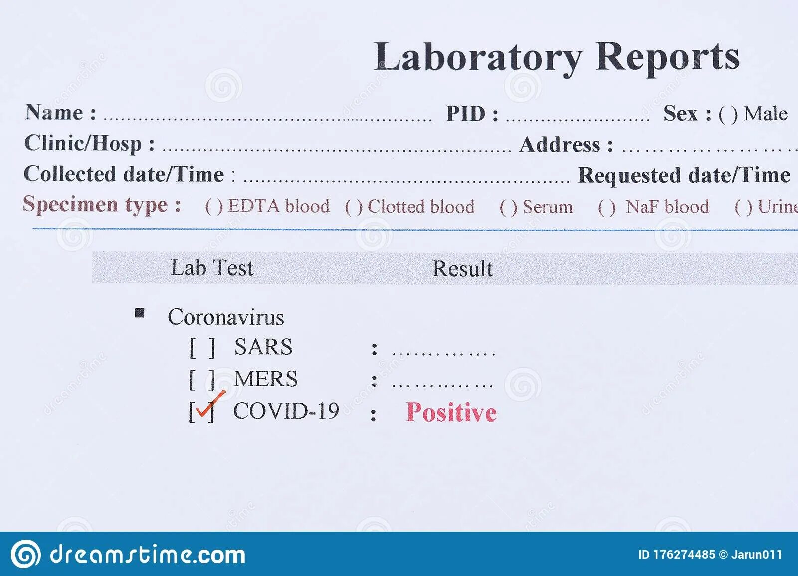 Your result тест. Positive Covid Test. Covid 19 positive Test. Covid-19 Test Result. Covid Test Results.