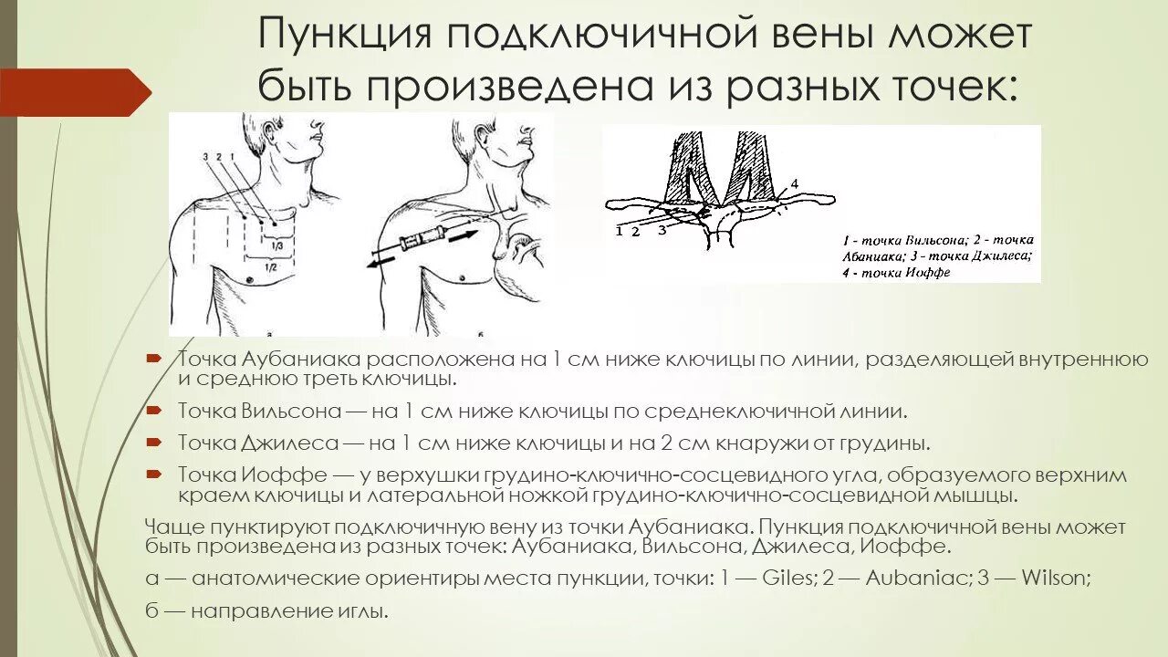 Уход за подключичным катетером. Методика пункции подключичной вены. Техника катетеризации подключичной вены. Точка пункции подключичной вены по Сельдингеру. Пункция и катетеризация подключичной вены техника.