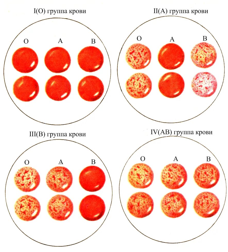 Как определить 4 группу крови. Белки определяющие группу крови. Как определить группу крови 1 положительная. Группа крови 2 отрицательная как определить. Группа крови д 1
