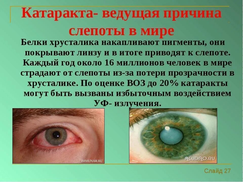 Возникновение глаза