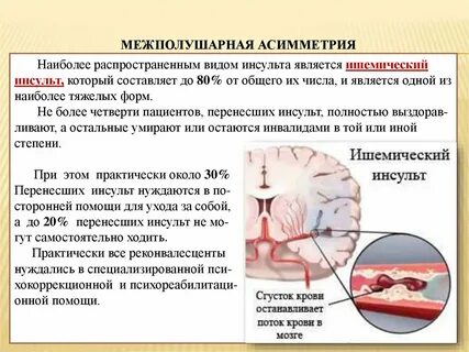 Признаки асимметрии
