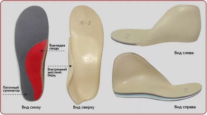 Нога имеет плоскую ползательную подошву. Ортопедические стельки при варусной деформации. Ортопедические стельки вальгусная деформация стопы. Ортопедические стельки при вальгусной деформации и плоскостопии. Ортопедические стельки при халюс вальгус.