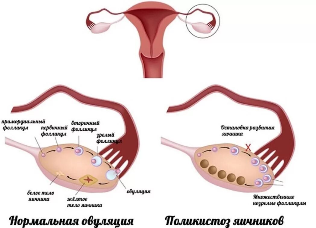 созревание яйцеклетки. цикл менструационного цикла и овуляция. фазы созревания яйцеклетки. доминантный фолликул 19мм эндометрии 7мм узи. овуляторный цикл схема.
