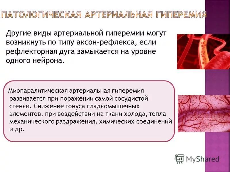 Физиологическая артериальная гиперемия