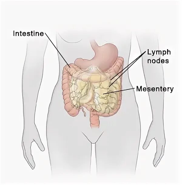 Лимфатические узлы в кишечнике. Мезентериальный мезаденит. Неспецифический мезаденит. Мезентериальные лимфатические узлы в брюшной полости.