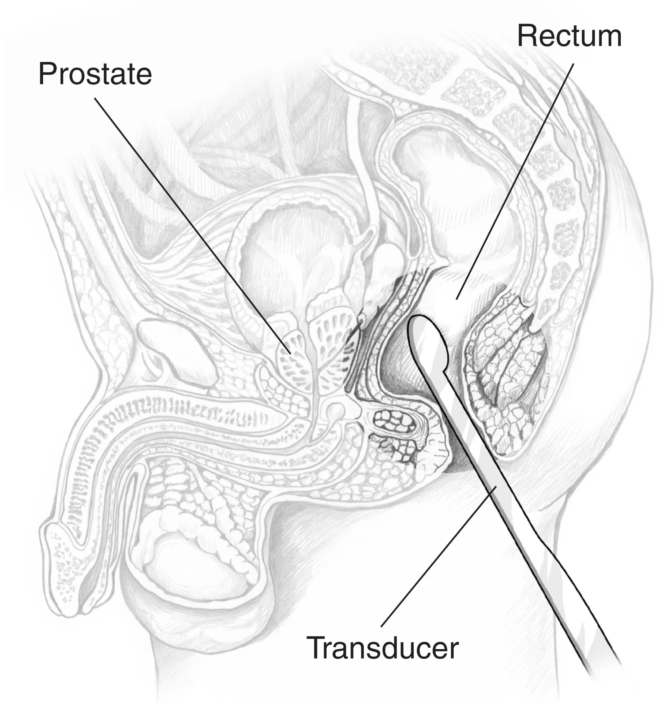 Простаты обучение. Трансректальное УЗИ простаты. Трансректальное пальцевое исследование предстательной железы. Трансректальный датчик УЗИ. Трансректальный датчик УЗИ размер.