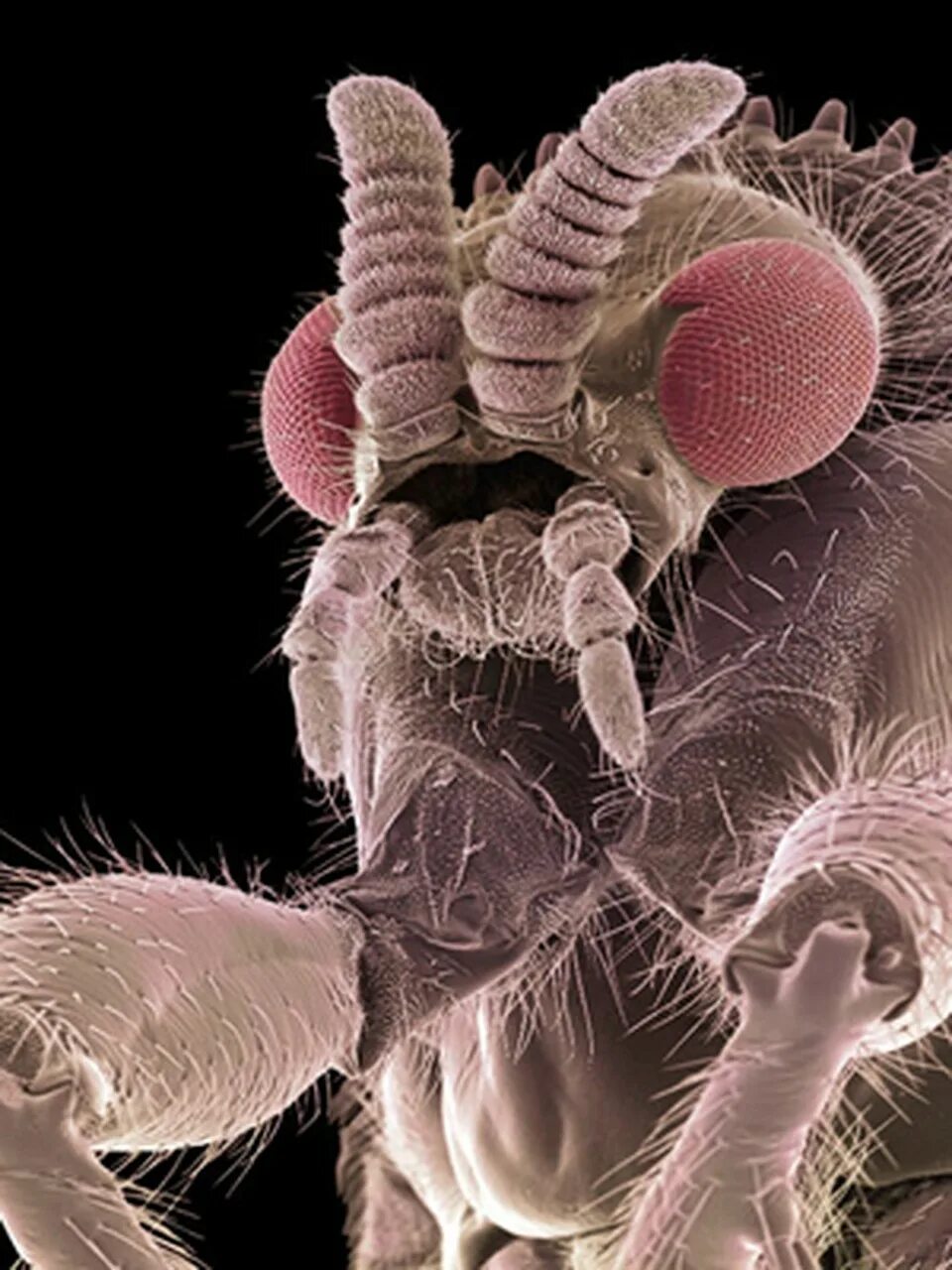 Мошка под микроскопом фото. Астраханская мошка под микроскопом. Бактерии под микроскопом. Мошка в микроскопе. Кусачая мошка под микроскопом.