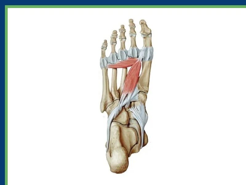 Связочный аппарат стопы. Межкостные связки стопы. Лигаментоз голеностопного сустава.