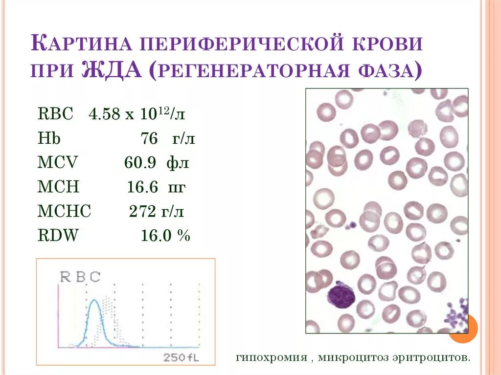 При железодефицитной анемии в анализе крови наблюдаются. Морфологическая картина крови при железодефицитной анемии. Картина периферической крови при железодефицитной анемии. Картина периферической крови при апластической анемии. Изменения периферической крови при железодефицитной анемии.