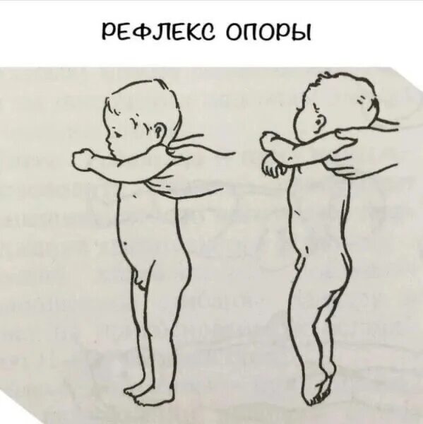 Рефлекс упражнение. Рефлекс опоры у новорожденных. Рефлексы новорожденного рефлекс опоры. Рефлекс опоры у грудничка. Опора на прямые руки у грудничка.