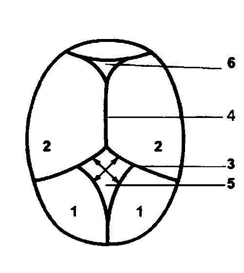 Родничку 1 3 на 1 3. Роднички у новорожденных анатомия. Измерение размеров большого родничка. Правильное измерение большого родничка. Измерение большого родничка у новорожденного.