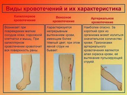 Капиллярное венозное кровотечение первая помощь