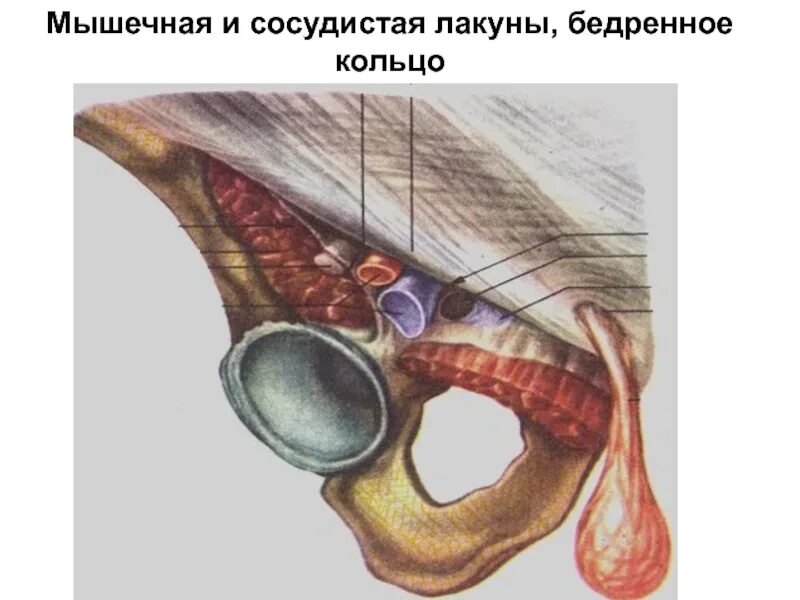 Что такое лакуна. Мышечная лакуна топография. бедренный канал сосудистая лакуна. мышечная и сосудистая лакуны бедра. сосудистая лакуна топография.