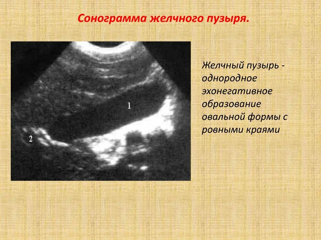 Определение сократимости желчного пузыря